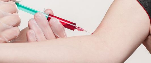 MEDIAN treibt Aufklärung zu Lipoprotein(a) als Risikofaktor frühzeitiger Herzinfarkte voran MEDIAN treibt Aufklärung zu Lipoprotein(a) als Risikofaktor frühzeitiger Herzinfarkte voran
