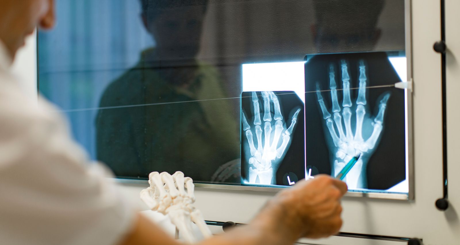 Ärztin betrachtet das Röntgenbild der Hände