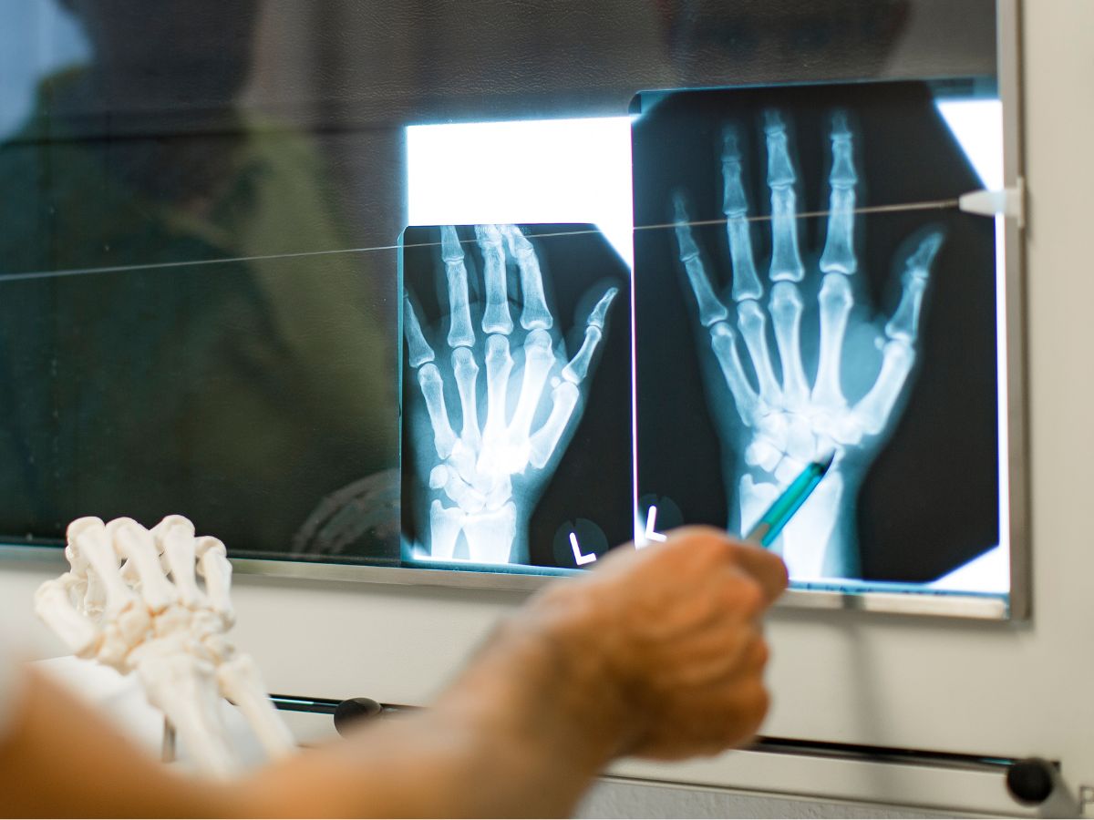 Ärztin betrachtet das Röntgenbild der Hände
