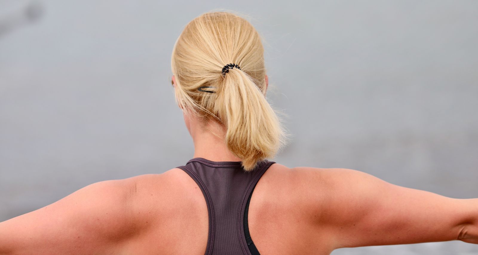 Eine Frau mit Sonnenbrand auf dem Rücken 